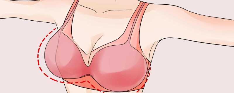 乳房淋巴结需手术吗