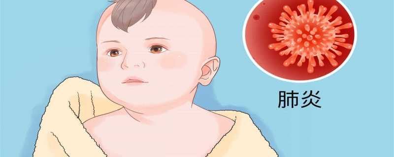 如何預防新生兒臍炎