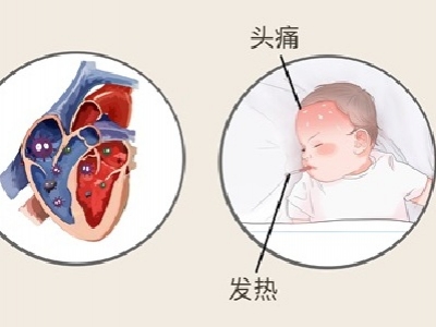 心肌炎是怎么引起的