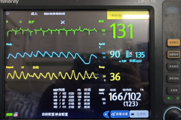 窦性心律不齐是指什么意思