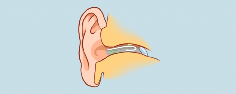 耵聹栓塞會(huì)聾嗎