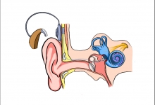人工耳膜可以恢復(fù)聽力嗎}