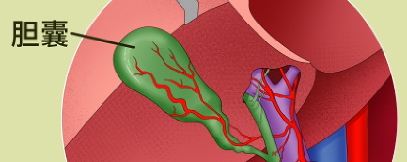胆囊瘤是怎么回事}