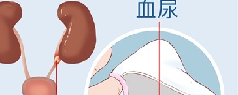 白头翁可以治疗血尿吗