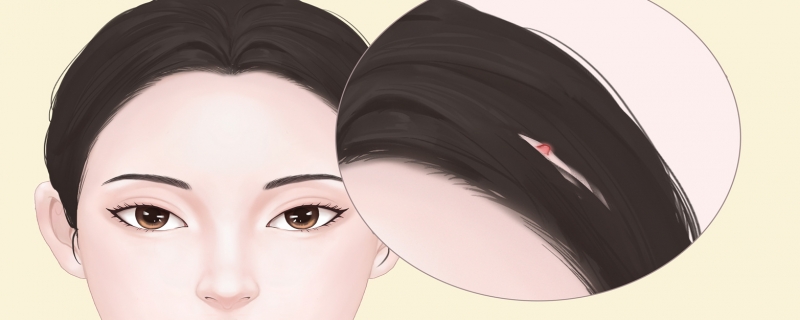 鳞状细胞癌和皮肤癌的区别是什么}