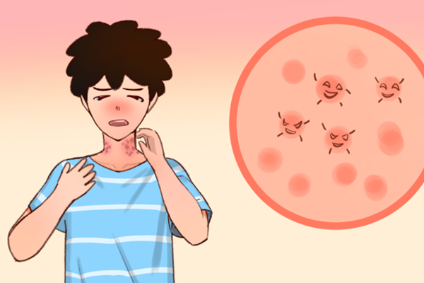 如何治湿疹