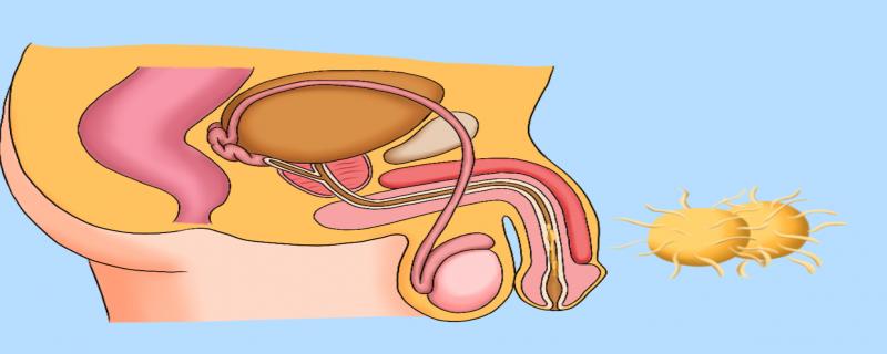 男性淋病的症状有什么