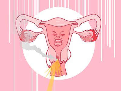 子宫内膜异位症可以做试管吗 子宫内膜异位能做试管吗