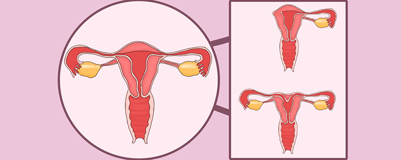 女性不育的常见原因是什么