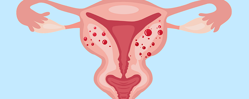 宫内囊性结构是什么原因