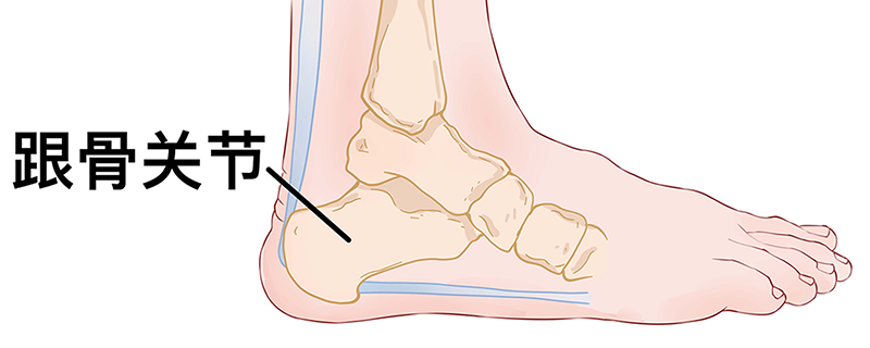 跟腱痛是什么原因