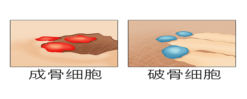 母細(xì)胞瘤是怎么造成的}