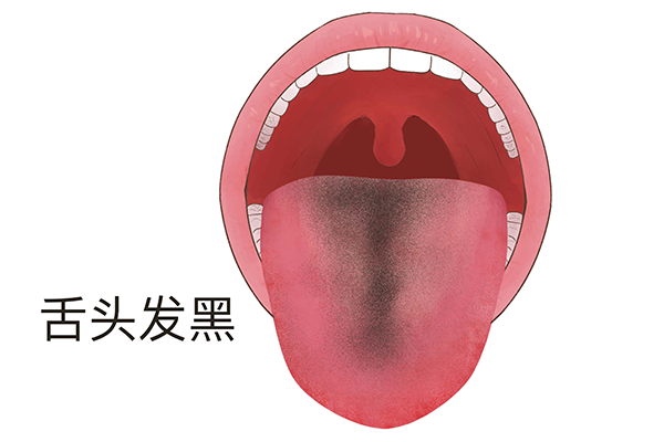 舌头发黑的原因是什么