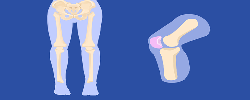 膝盖劳损能彻底恢复吗}