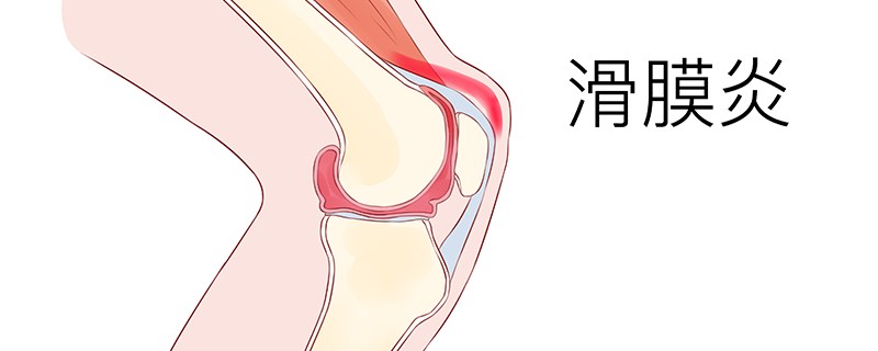 滑膜炎手術風險大嗎