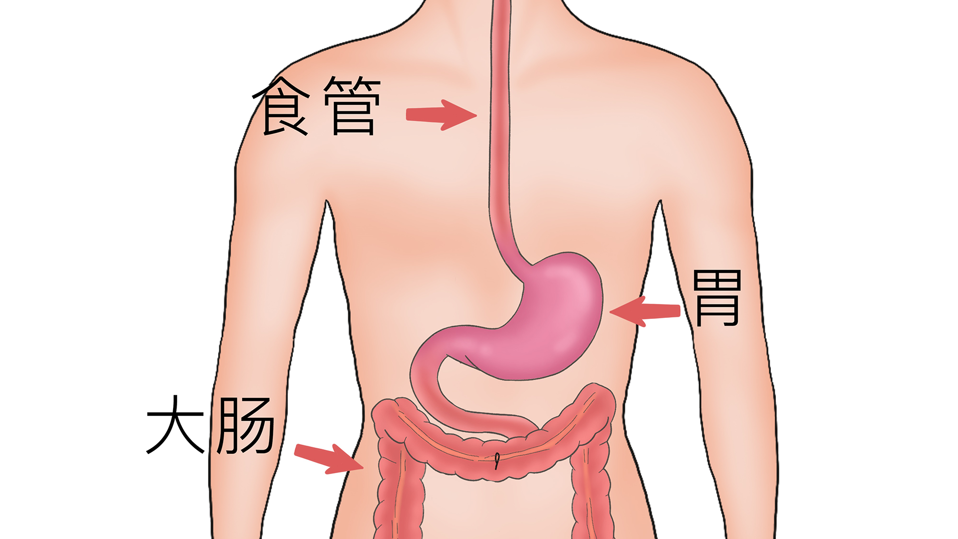 胃食管反流多久能好}