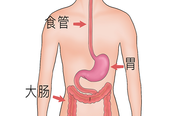 胃食管反流症如何用药