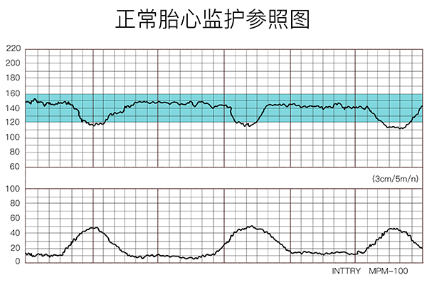 SV正常值范圍