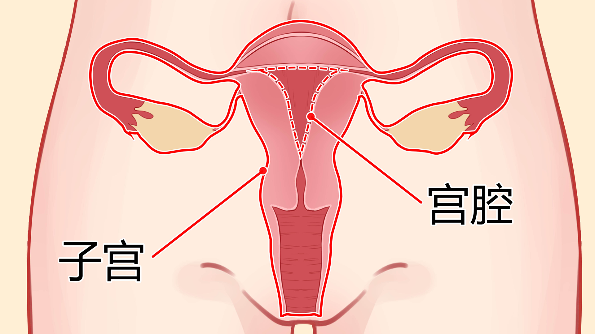 子宫着床有什么反应吗