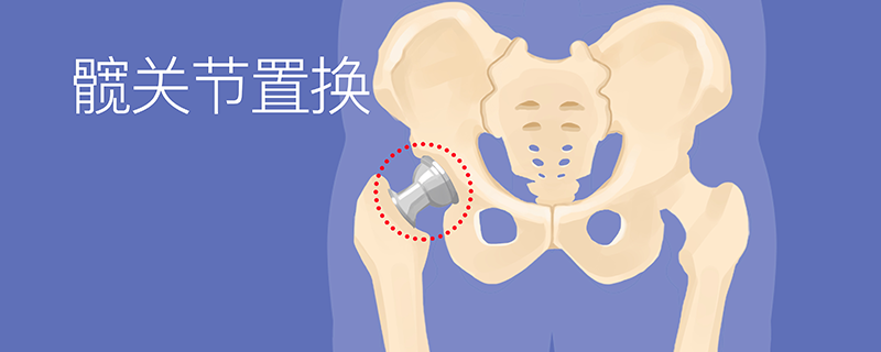 腿和胯骨連接處疼怎么回事，怎么辦