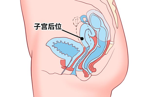 孕酮低治疗方法