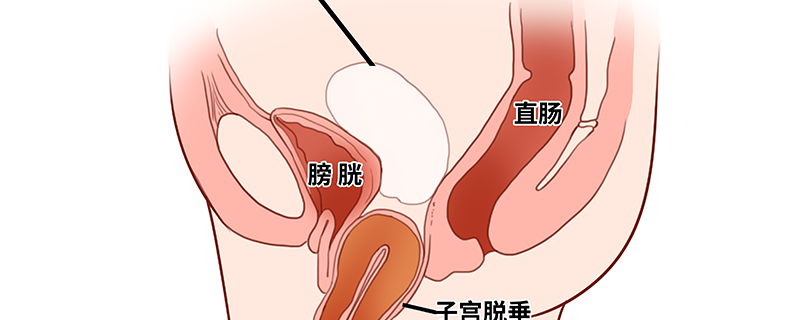 直腸癌大便能檢測(cè)出來(lái)嗎}