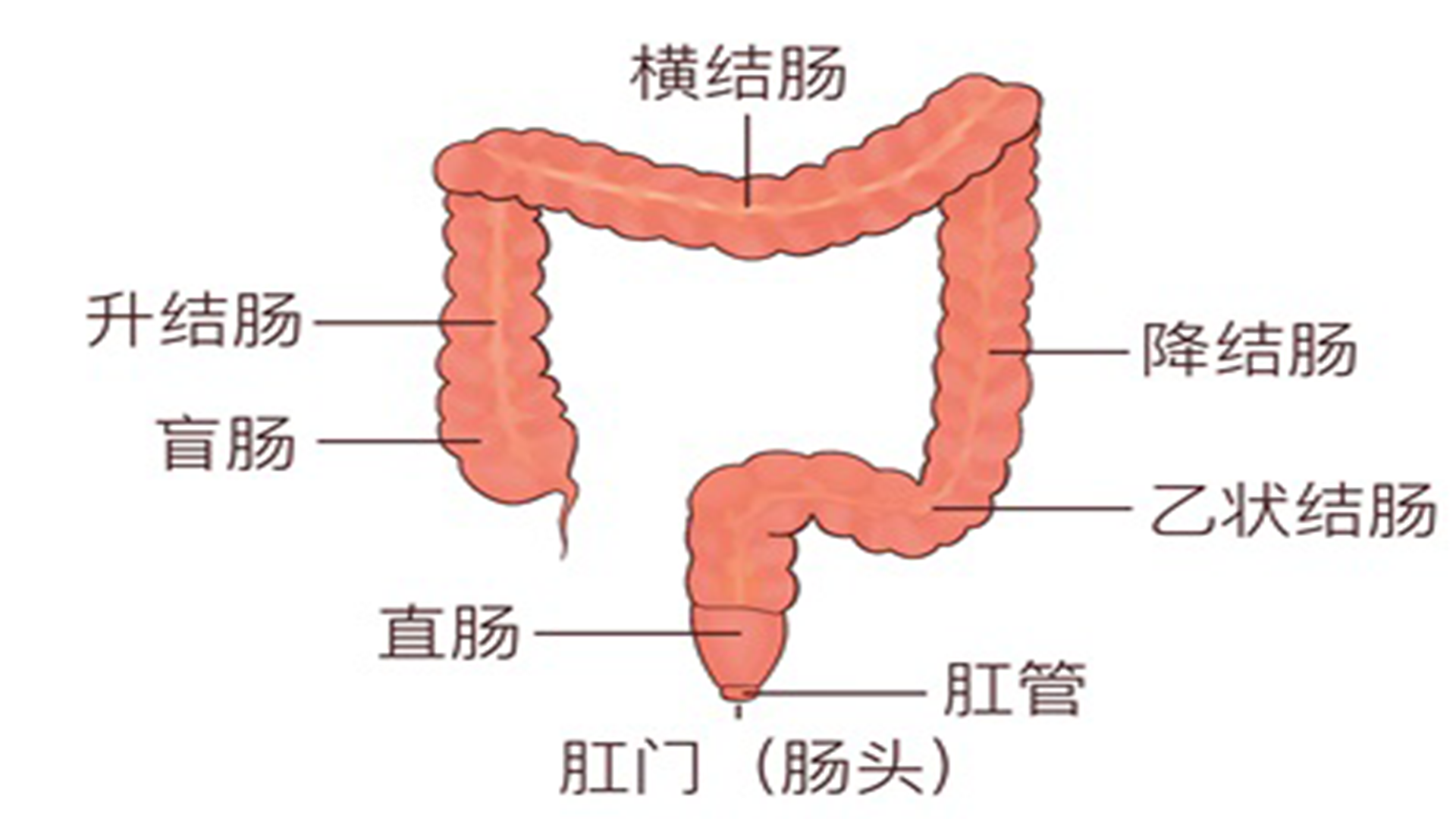 乙状结肠息肉可怕吗