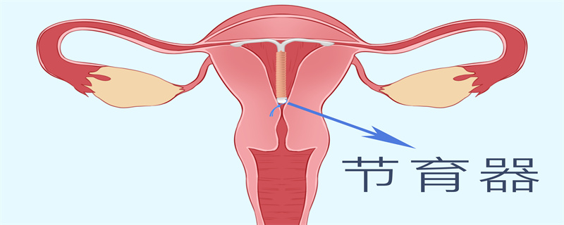 上环了会怀孕吗