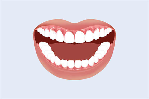 中老年人缺牙有什么影响？