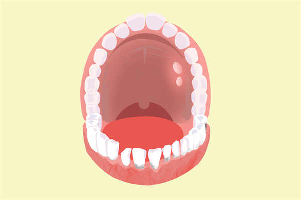 舌苔发黄厚腻是什么原因怎么调理