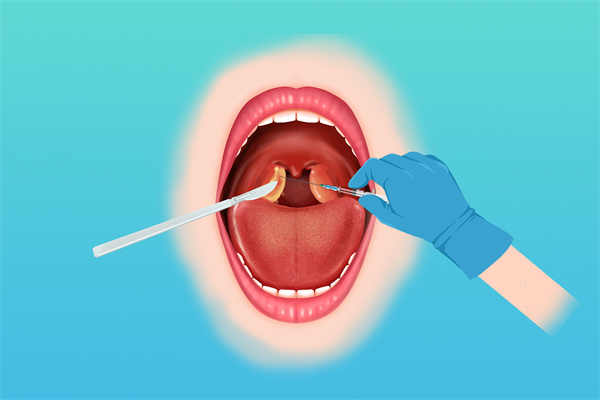 口腔溃疡反复发作是怎么回事