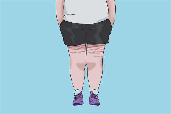常见的减肥误区都有哪些