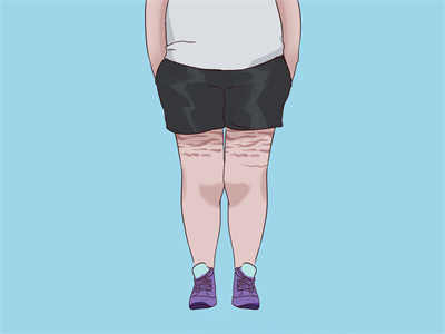 医生称贾玲式减肥要有诊疗团队 贾玲式减肥要把减肥当工作