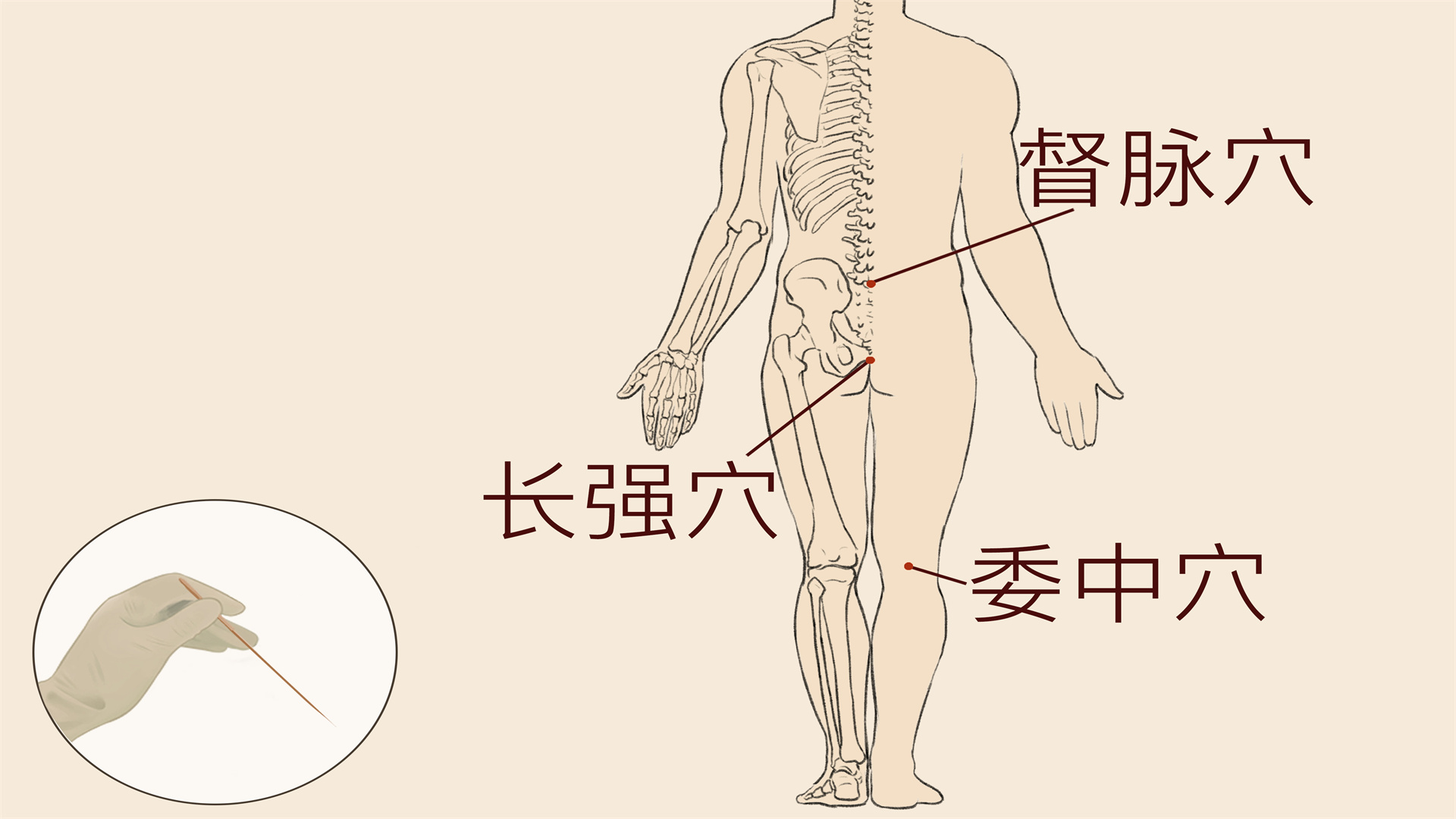 强直性脊柱炎算不算大病