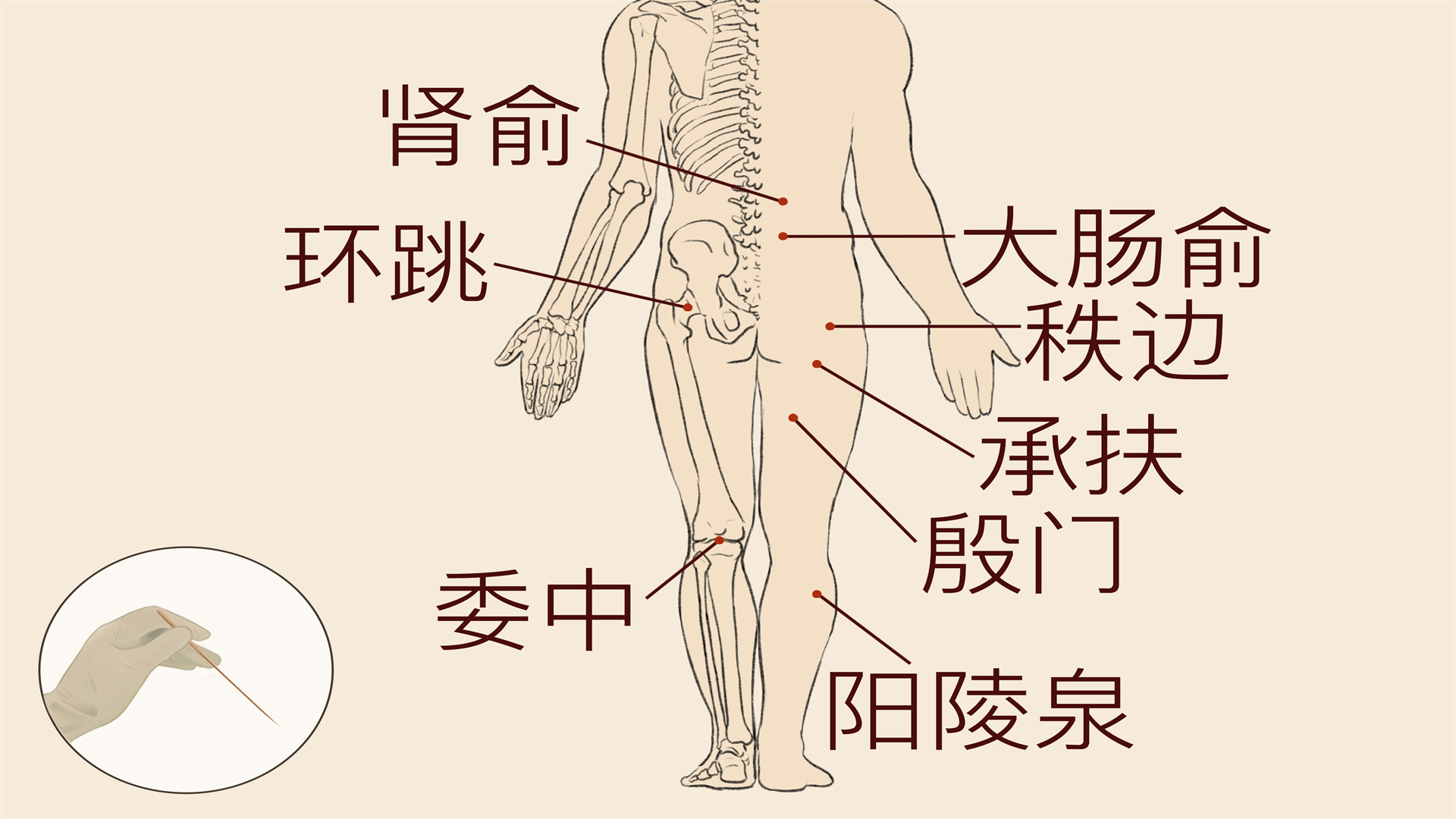 腰间盘突出能根治吗}