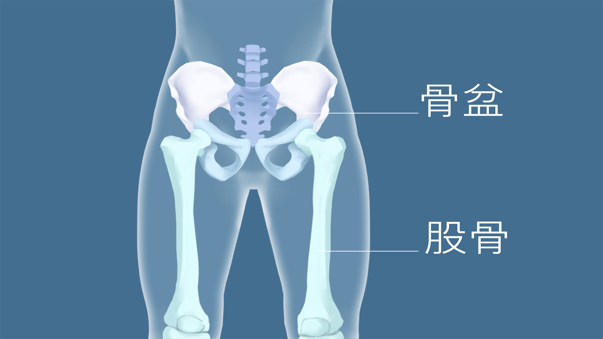 股骨頭壞死能自愈嗎