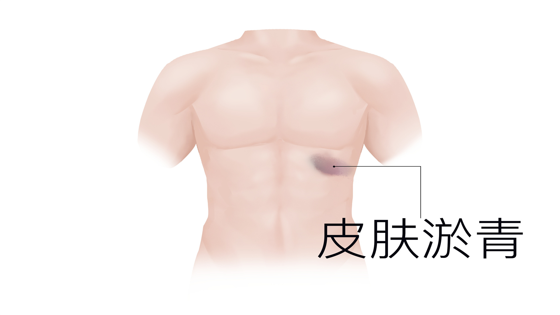 雷諾病的癥狀與原因有哪些}