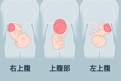 5分钟胎动4次算一次吗