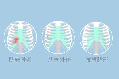 肋骨头疼是什么原因引起的}