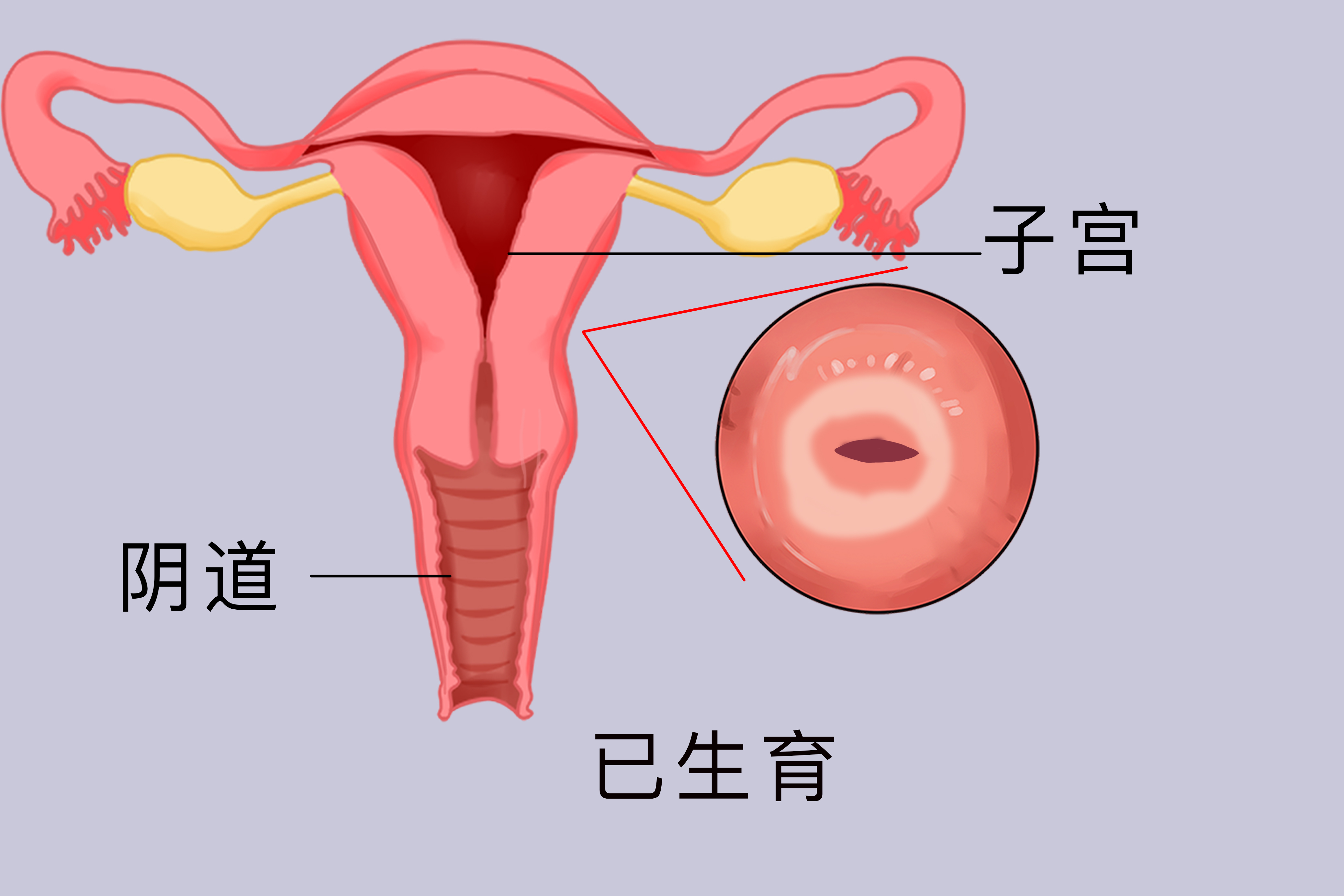 做彩超能看见宫颈上长的东西吗