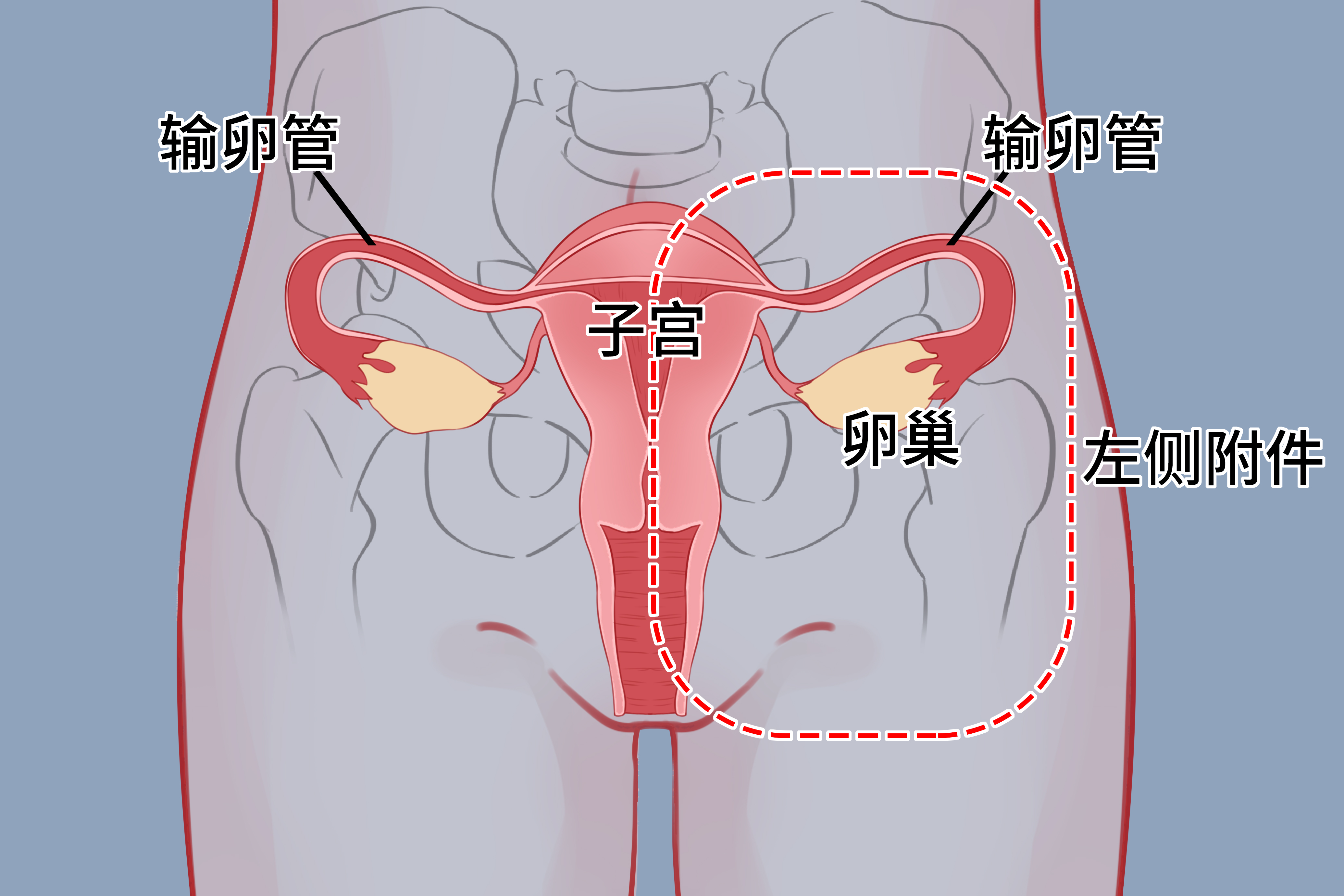 附件炎反復發(fā)作是什么原因