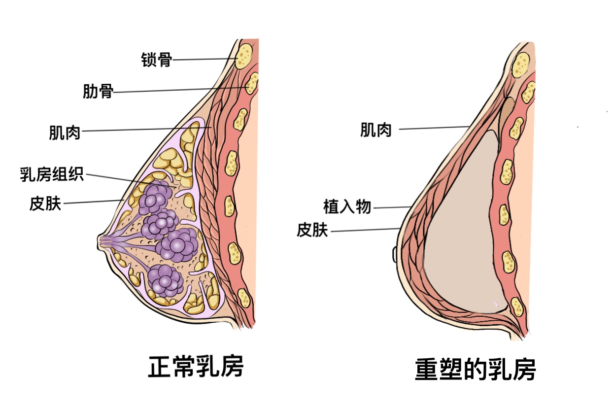 怀孕后乳房变黑正常吗