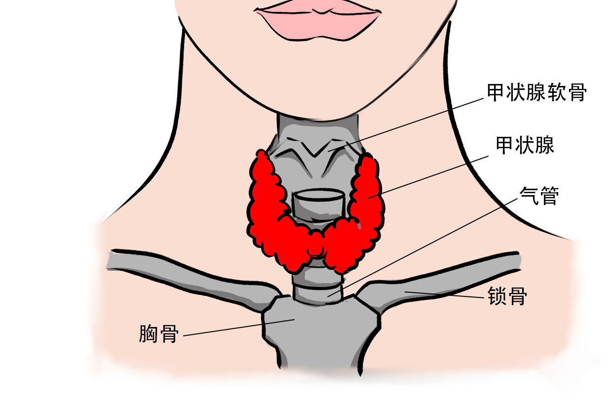 內(nèi)消瘰疬丸可以治療甲狀腺結(jié)節(jié)嗎}