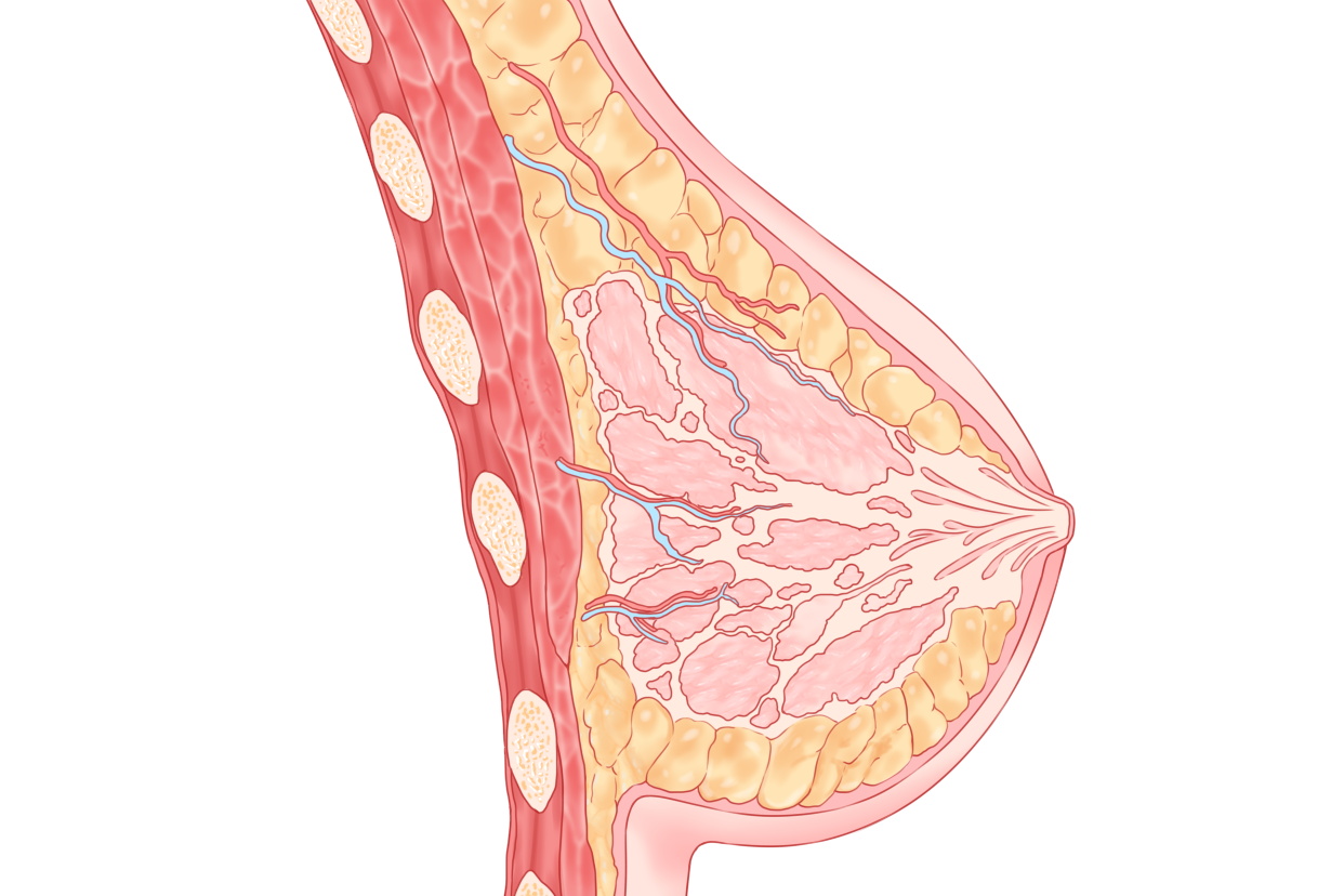 乳腺穿刺后一定要手术吗}