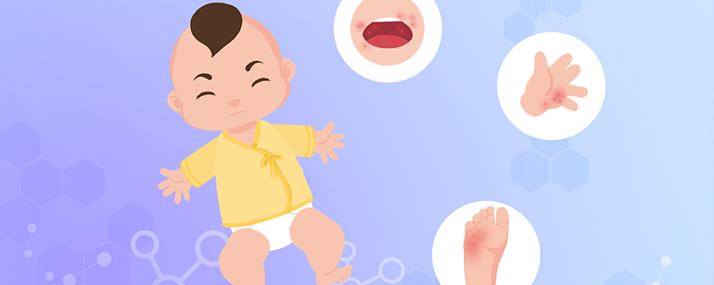 2个月宝宝佝偻病有哪些症状