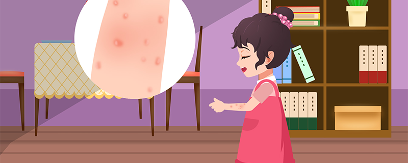 过敏荨麻疹是什么原因导致的
