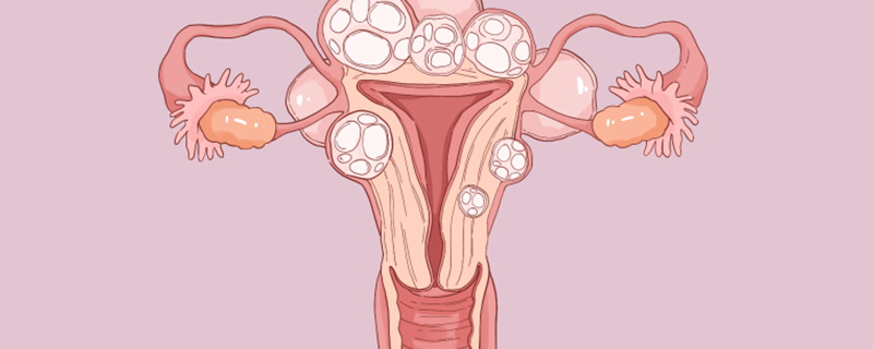 孕期子宮肌瘤是怎么引起的