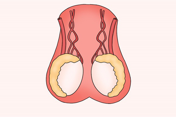 睾丸疾病有哪些
