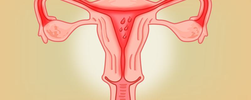 子宮肌瘤有哪些注意事項