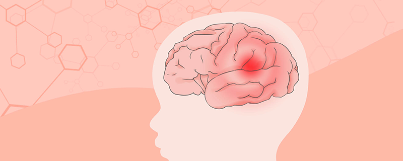 脑梗塞和脑卒中的区别是什么